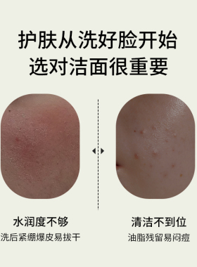 NEWFACE新面孔氨基酸控油洗面奶