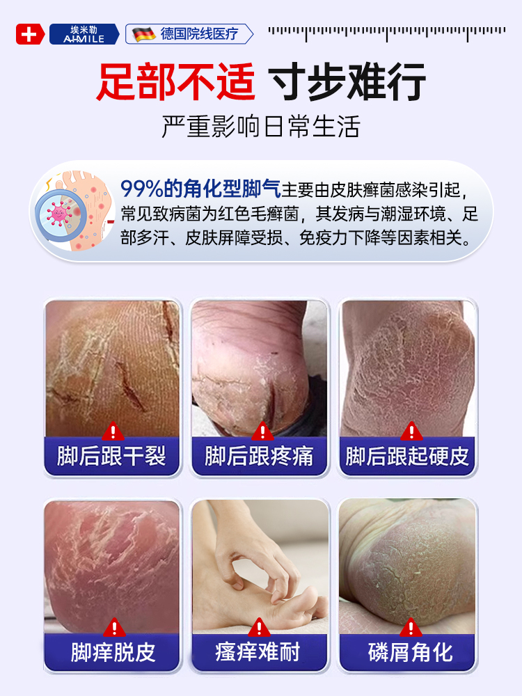 医用去脚后跟干裂真菌感染角化型脚气专用特效根止痒脱皮杀菌正品 - 图0