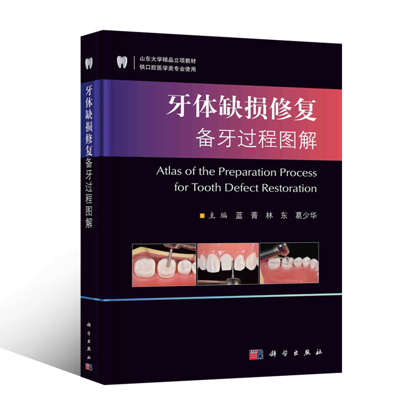 现货速发 牙体缺损修复备牙过程图解 葛少华 著 前后牙全瓷冠 贴面 嵌体 临床常用修复体的牙体预备过程 开窗型前牙瓷贴面牙体预备 - 图3