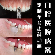 2023 Oral Hospital Planting Teeth Tridimensional Animation Narration Dental Department Publicity Education TV Material Video Production