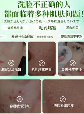 绿之密语控油祛痘深层清洁洗面奶