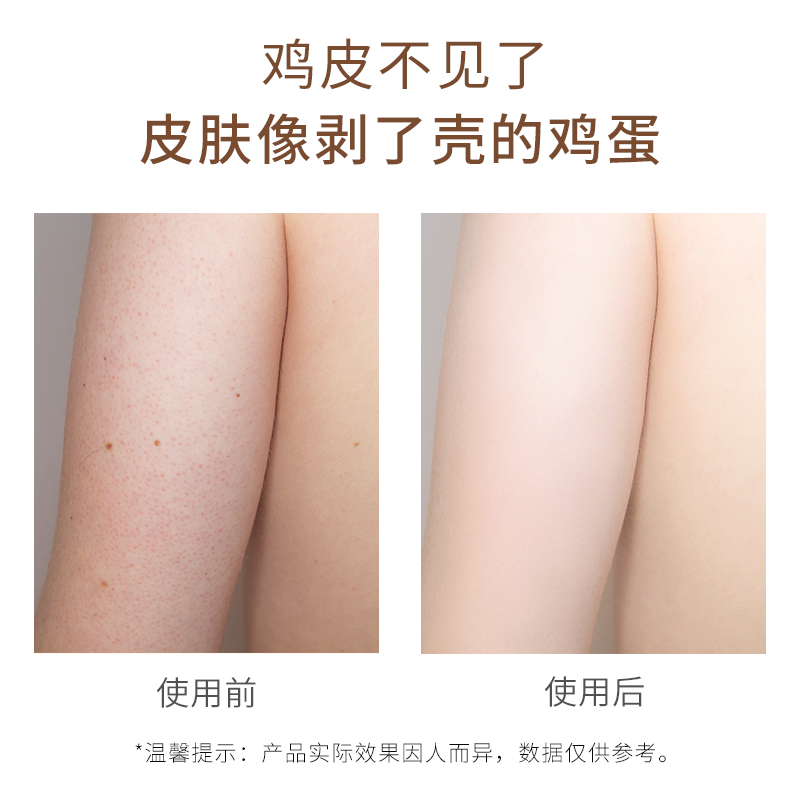 健美创研旗舰店身体磨砂膏乳木果去鸡皮肤去角质嫩白脸部全身去除死皮疙瘩毛囊女2