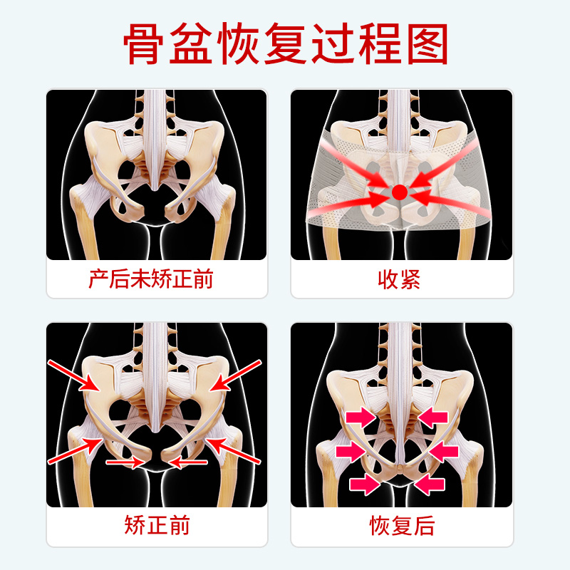 盆骨带骨盆前倾产后耻骨联合分离收假胯宽骨盆带收胯骨神器矫正带 - 图2