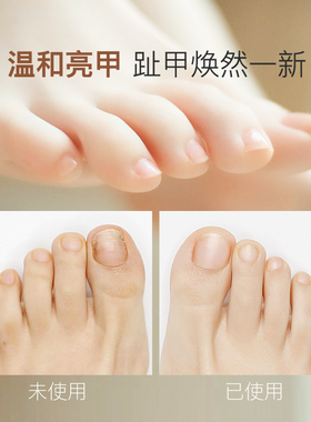 匹奇电动磨脚器去死皮老茧刀神器