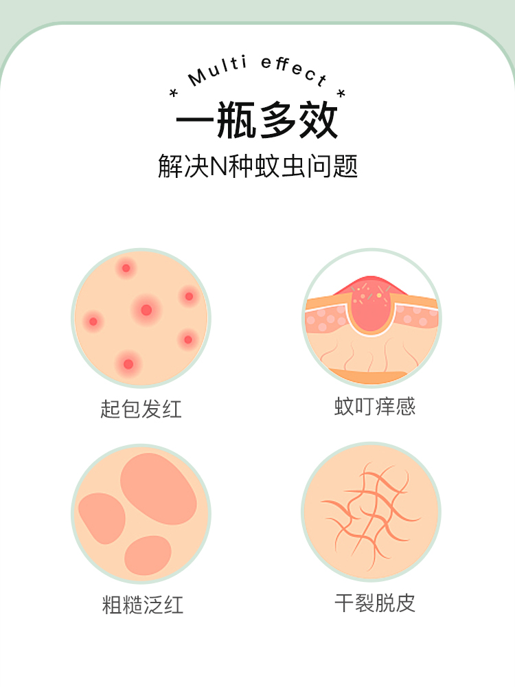 美国OhBases欧比信婴儿童宝宝驱蚊滚珠小绿珠防蚊虫叮咬止痒消包 - 图1