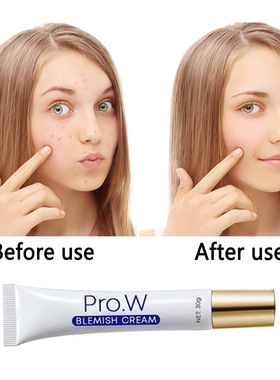 Dark Spots Whitening Cream Brighten Melanin Melasma Blemish