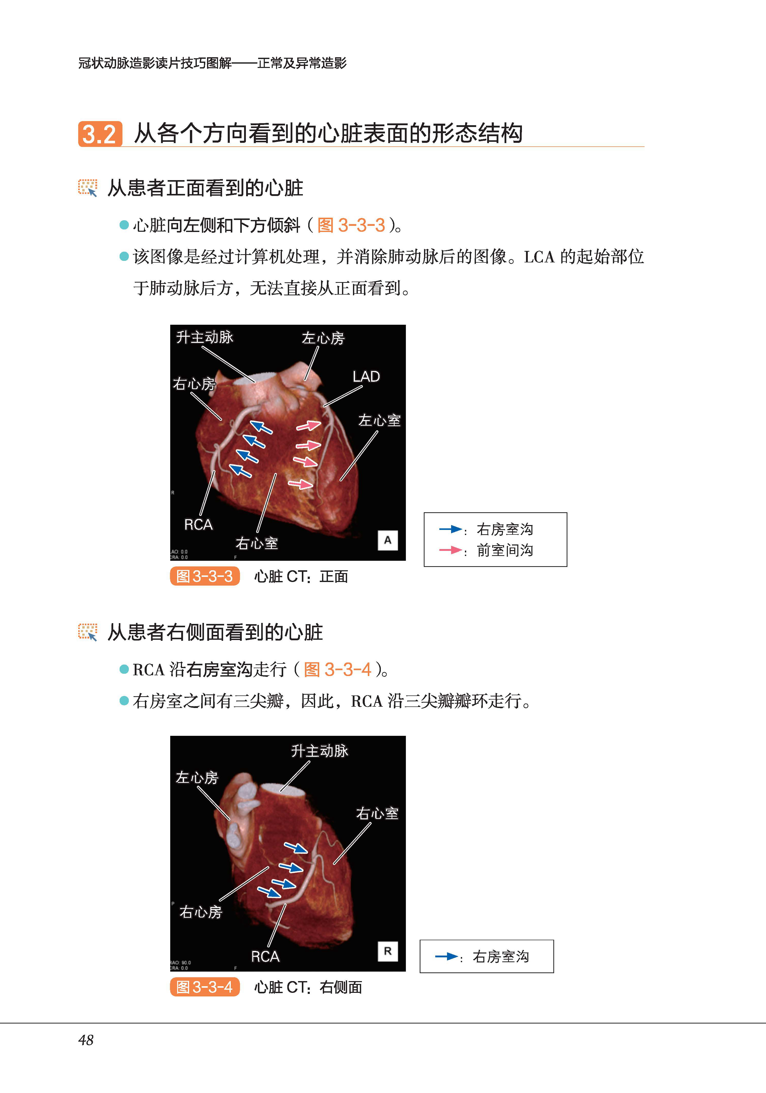正版包邮 冠状动脉造影读片技巧图解 正常及异常造影 教你从冠脉造影小白 快速进阶PCI达人中川义久林秀隆 北京科学技术出版 - 图1