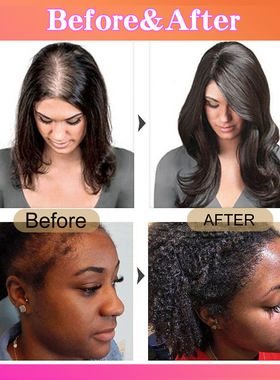 Batana Oil for Hair Growth巴塔纳油护发素滋润修护强韧防掉密发