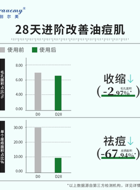 创尔美水杨酸棉片黑头闭口