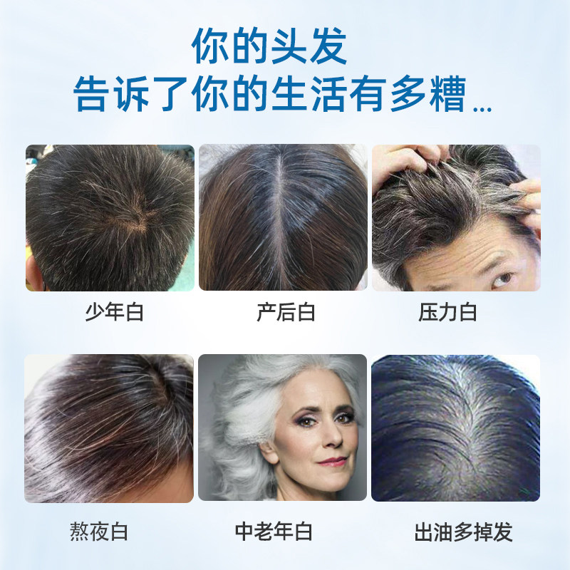 胶囊养发美国进口维生素b维生素h 宜度海外B族维生素