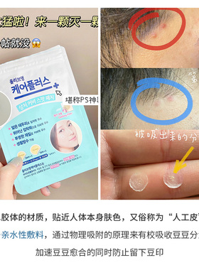 韩国olive young隐形痘痘贴炒薄急救贴青春痘贴净痘贴不留痕102贴