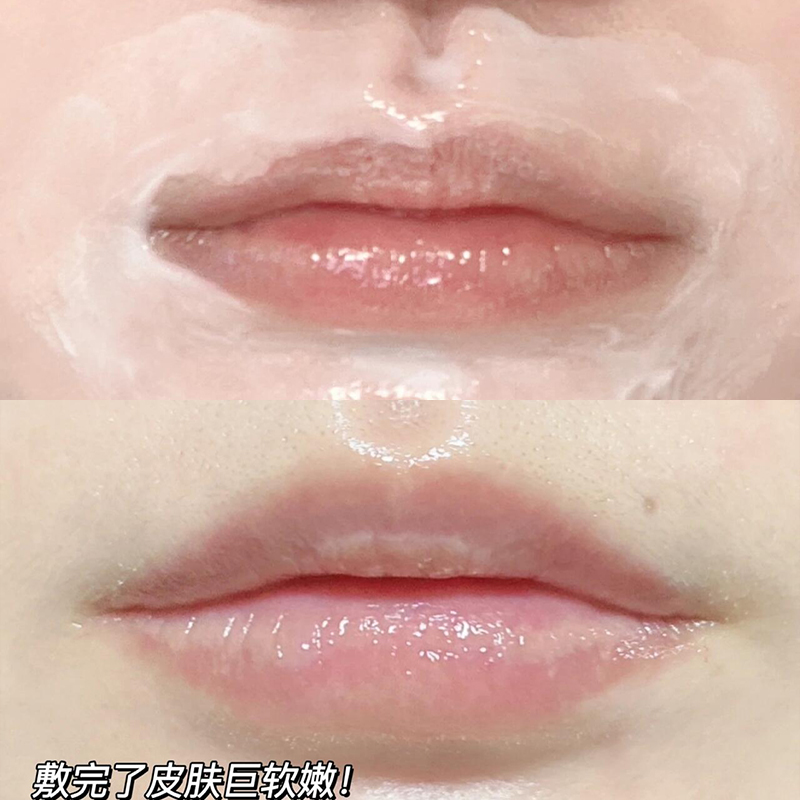 保税 德国ISANA VC精华乳50ml维C美白提亮唇周黑暗沉肤色淡化痘印 - 图1