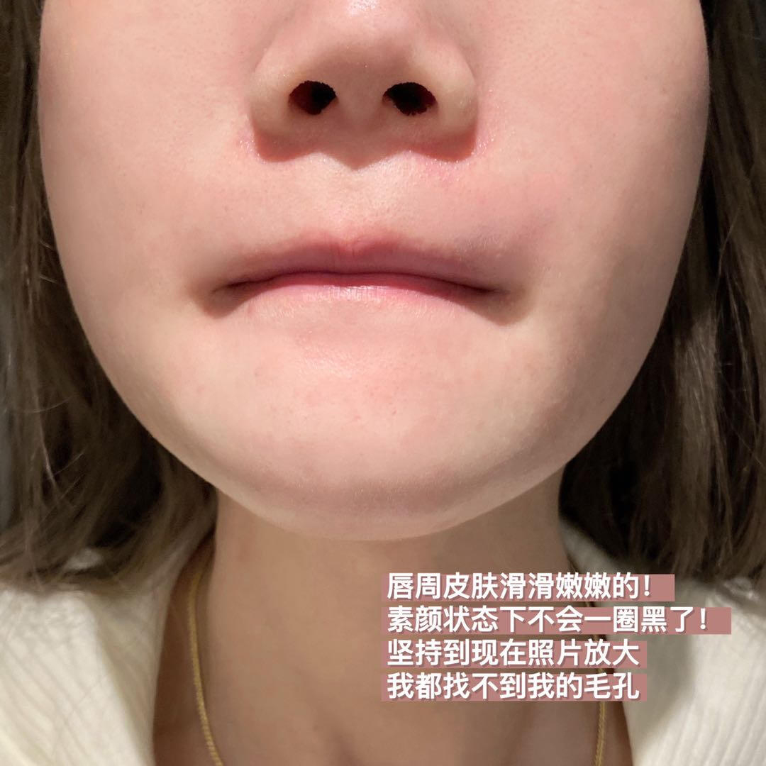 保税 德国ISANA VC精华乳50ml维C美白提亮唇周黑暗沉肤色淡化痘印 - 图2