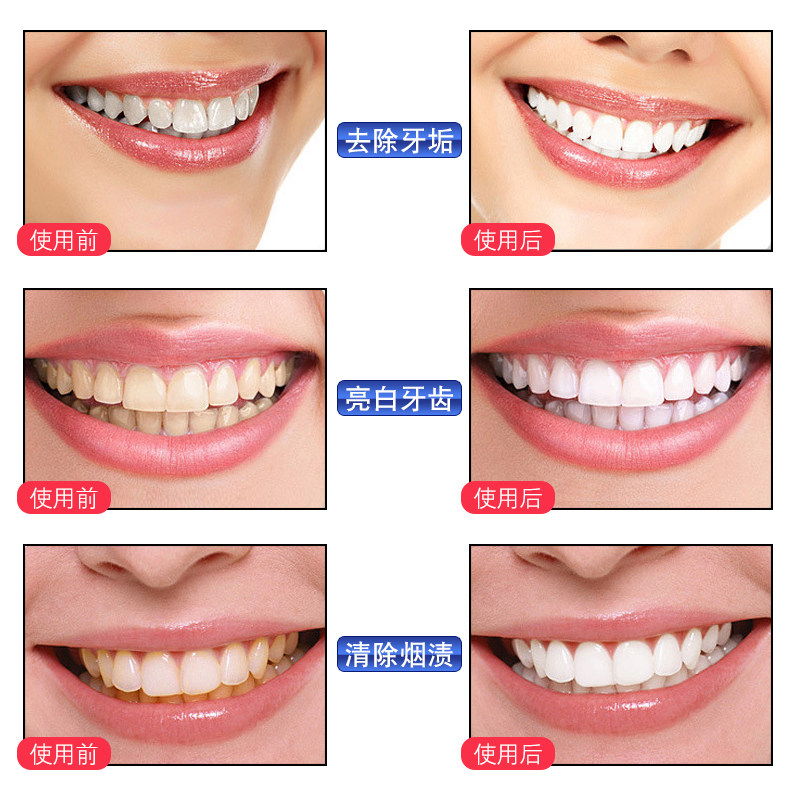 珂宜洗牙粉去黄牙结石烟刷牙白牙素 沁宜居家日用牙粉