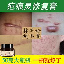 Scar Lingering Comeback Paste Hyperplasia Raised Bumps Surgery Scar Faint Scar Faint Black Pigment Precipitates Remove Pimple Print
