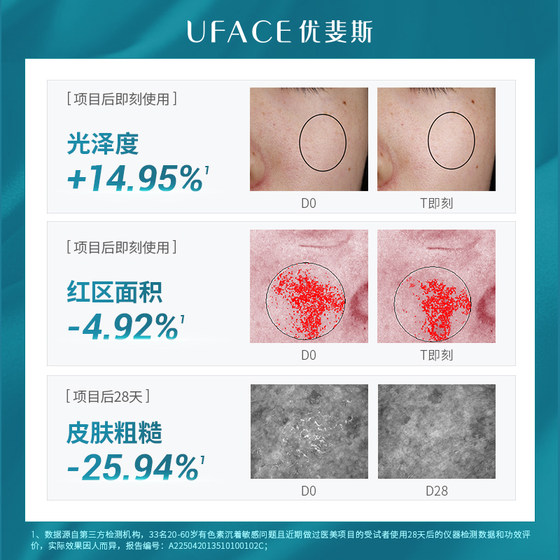 优斐斯氨甲环酸次抛精华液传明酸防反黑淡色沉敏肌专研
