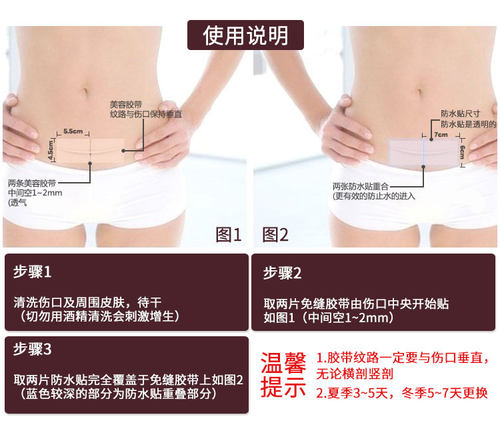 进口3M剖腹产手术1545PP美容免缝胶带疤痕贴减张预防疤痕 - 图0