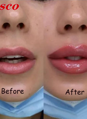 Lip Gloss Collagen Essence Moisturizer Lips 果冻滋润唇釉唇彩