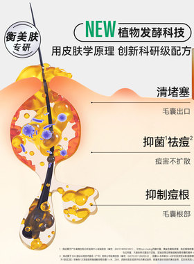 衡美肤臻透畅导粉刺祛痘祛黑头