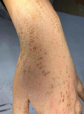 影视化妆皮肤龟裂胶粉末