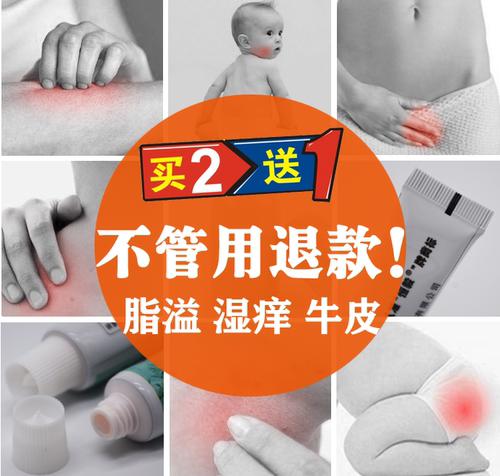 【芳平霜】用于神经性/脂溢/银屑/湿痒等皮肤 无激素 买2送1 - 图0