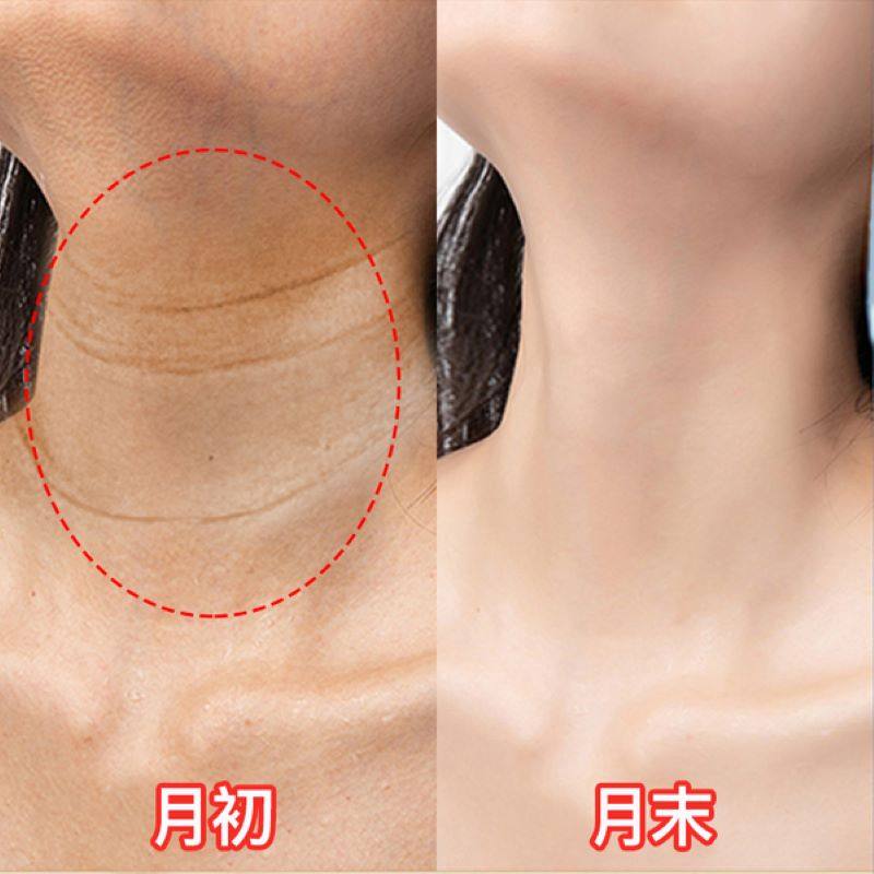 【12天去颈纹没用包退】去颈纹霜颈霜 素萃佰魅斯喷雾