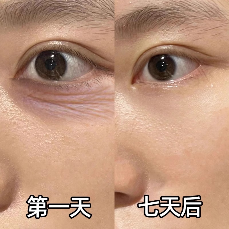 【好物同款】再见眼角纹 淡化黑眼圈 收缩眼袋提拉眼部男女通用