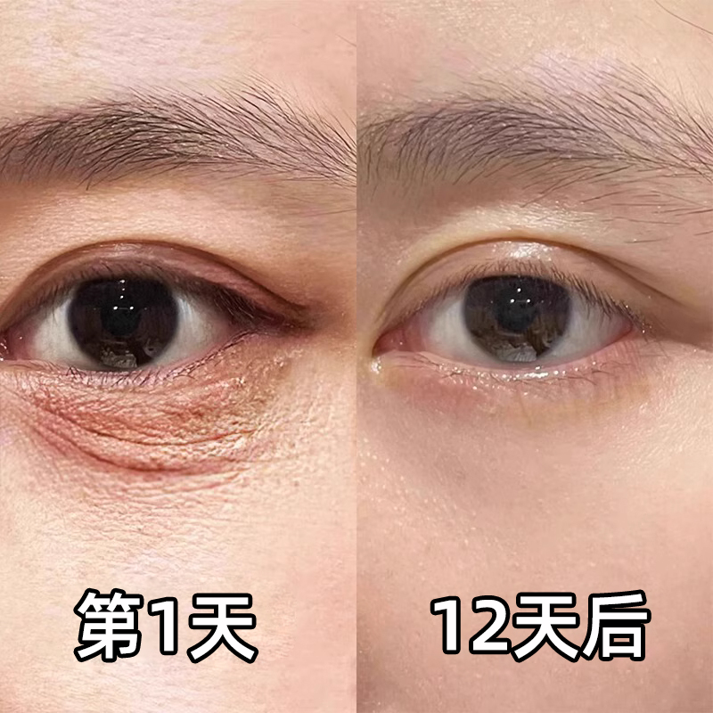 【小红书热推】再见眼角纹淡化黑眼圈收缩眼袋提拉眼部男女通用-图0