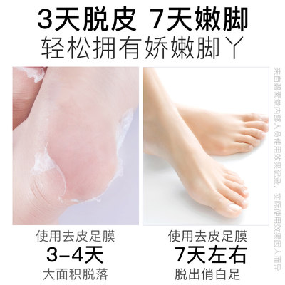 脚膜去脚后跟保湿补水滋润女男套脱蜕皮足膜 虎窝淘