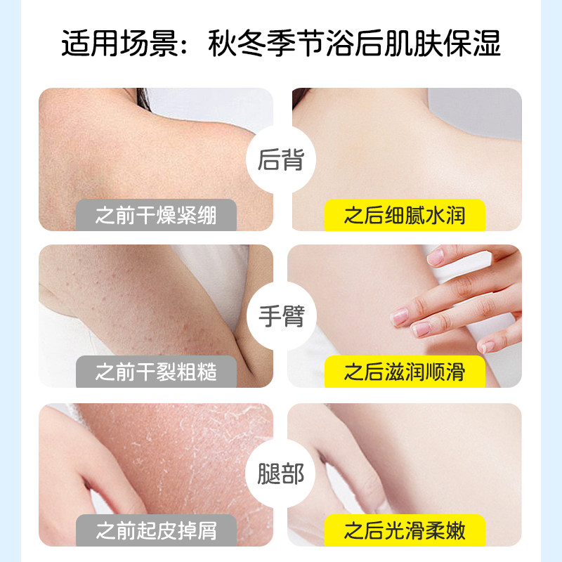朋禾乳木果儿童身体乳保湿滋润婴幼儿秋冬面霜宝宝霜300g大容量