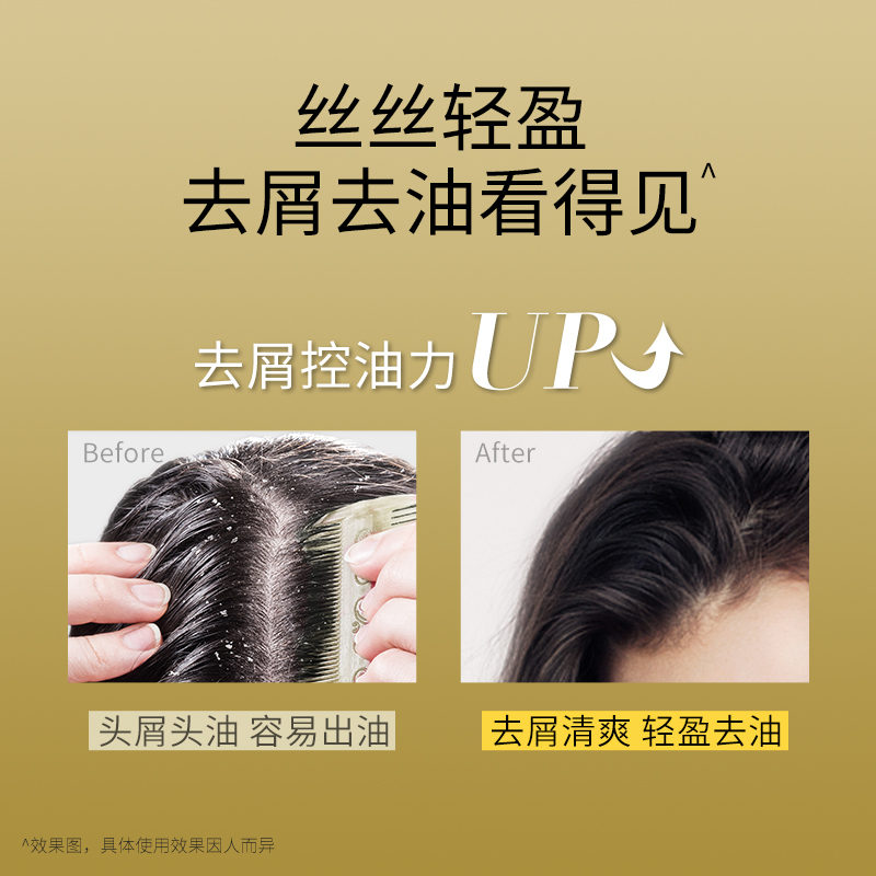 美多丝生姜固发滋养去油净屑精油洗发水女控油蓬松洗发露洗发膏