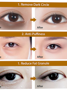 60pcs Hyaluronic Acid Repair Eye Patches Remove Dark Circles