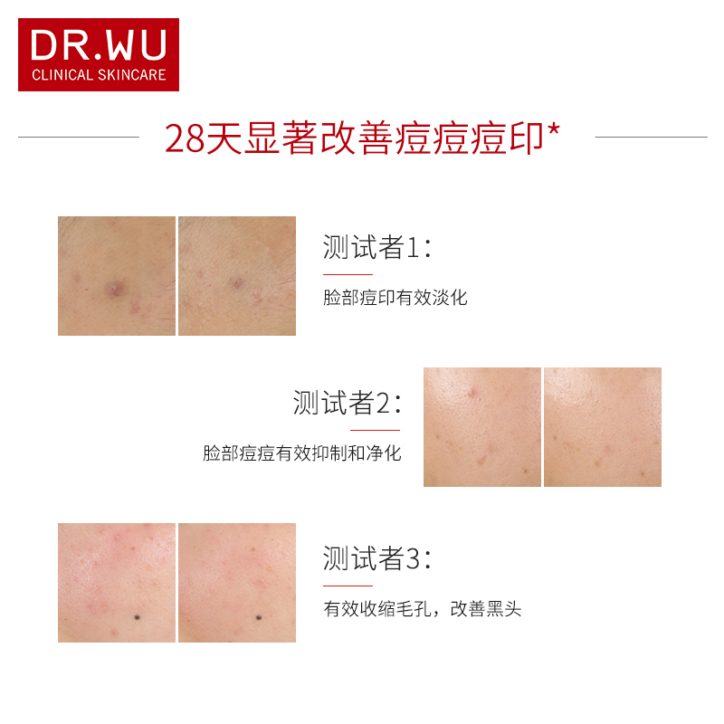 DR.WU 祛痘痘印去閉口黑頭收縮毛孔 達爾膚杏仁酸煥膚精華液水楊酸 DR.WU 祛痘痘印去閉口黑頭收縮毛孔 達爾膚杏仁酸煥膚精華液水楊酸