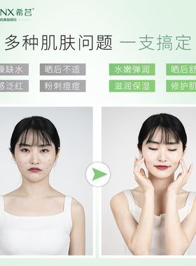希芸芦荟胶补水保湿晒后修护凝胶