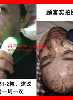 美容院专用芦荟净肤胶囊面部导出超声波脸部清洁排导 非铅汞毒