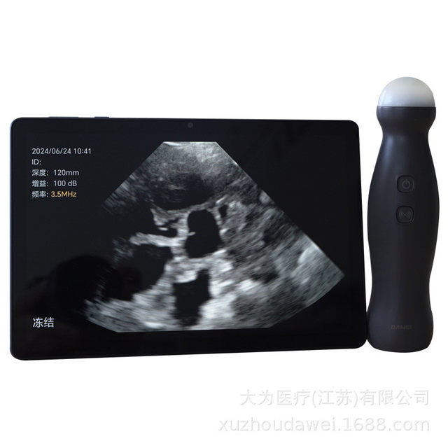 Ultrasound machine for pigs and sheep, special B-ultrasound machine for sow farm, b-ultrasound machine for animal husbandry, handheld mobile phone tablet wireless ultrasound