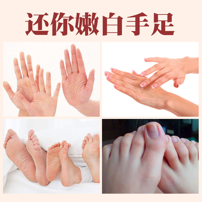 艾霸旗舰店艾霸冻疮膏马油滋润手脚干裂冻冬季手足部开裂护手霜男女2