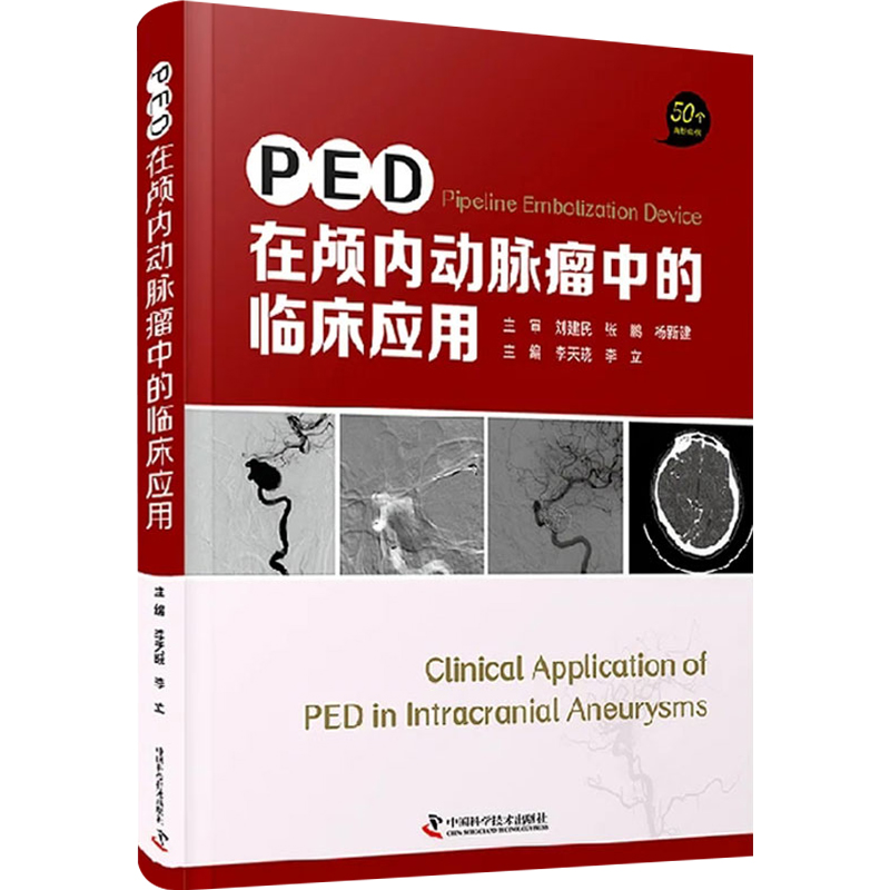 正版 PED在颅内动脉瘤中的临床应用 50个经典案例 李晓天 李立 主编 脑实质出血 Pipeli - 图3