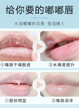 美肌卫士滋润补水唇萃之吻润唇膏