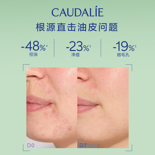 Otili Little Green Bottle Essence 30ml Oil Control Acne Removal Mixed Oil Oil Skin Sensitive Skin