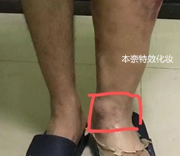 红肿铂金硅胶假皮 可融边假伤疤假皮  可按要求定制 本奈特效化妆