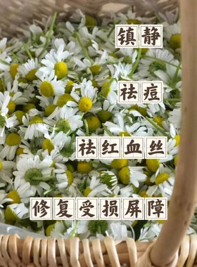 有机洋甘菊乳痘痘肌敏感肌红血丝