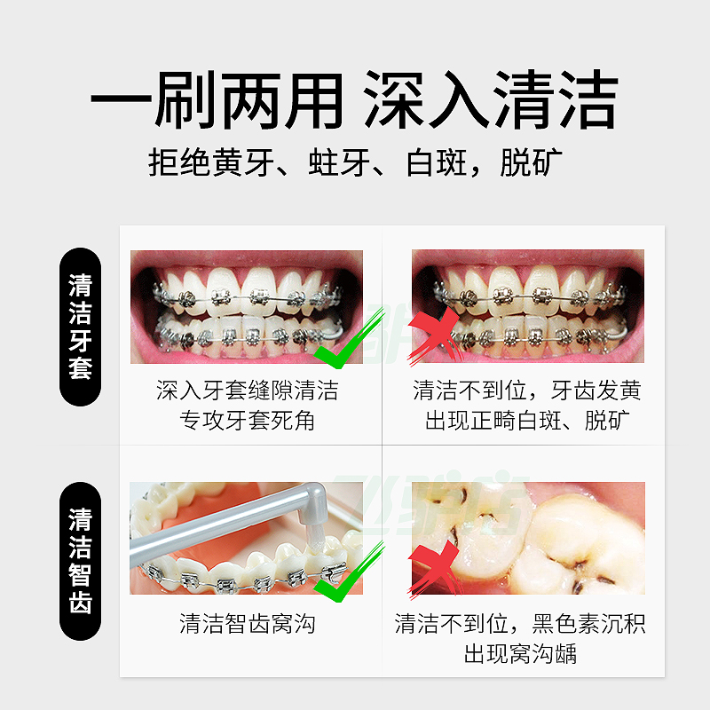 正畸牙刷支抗钉骨钉矫正专用整牙齿戴牙套刷智齿软毛清洁清理神器