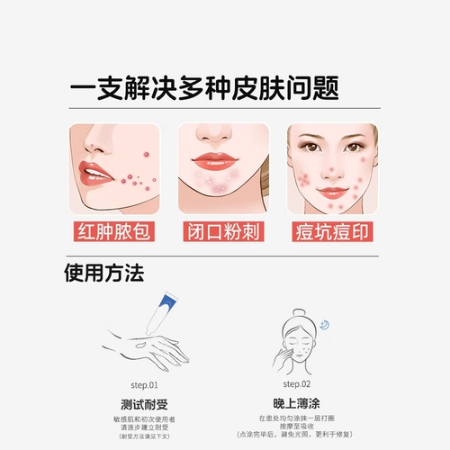 明康欣 Адапалиновый гель подлинный официальный флагманский магазин апалин мази с акне крем Метронидазол черный цвет