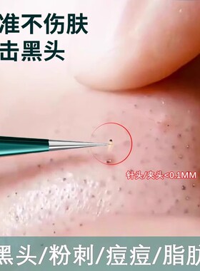 德国细胞夹黑头超细粉刺夹超尖黑头夹镊子刮去闭口美容院专用工具