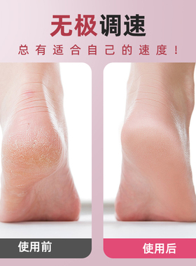 大功率电动磨脚器去死皮老茧