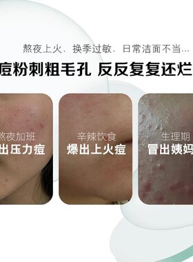 【正品】植物大师祛痘膏王二酸烟酰胺控油净润肌肤专业祛痘面霜膏
