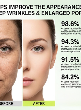 跨境视黄醇紧致精华液温和补水Retinol Eye Cream视黄醇紧致眼霜