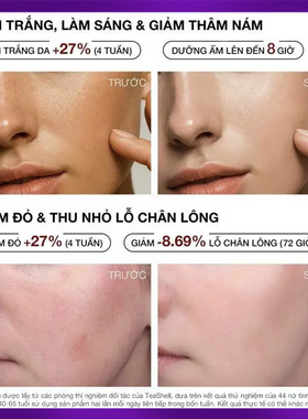 跨境爆款Niacinamide serum烟酰胺亮肤精华液保湿舒缓TK护肤