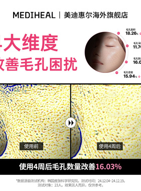 美迪惠尔改善毛孔玫瑰光泽面膜